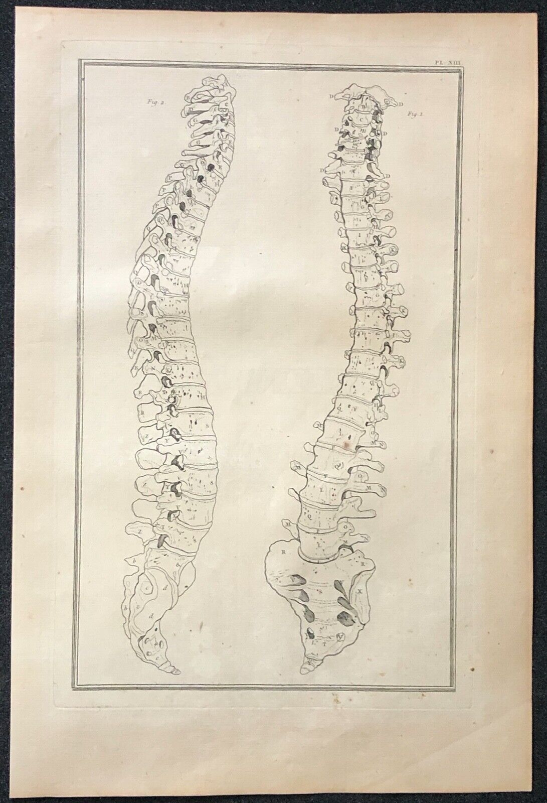 1759 Original Anatomical Engraving Human Spine Vertebral Column Osteology – Image 2